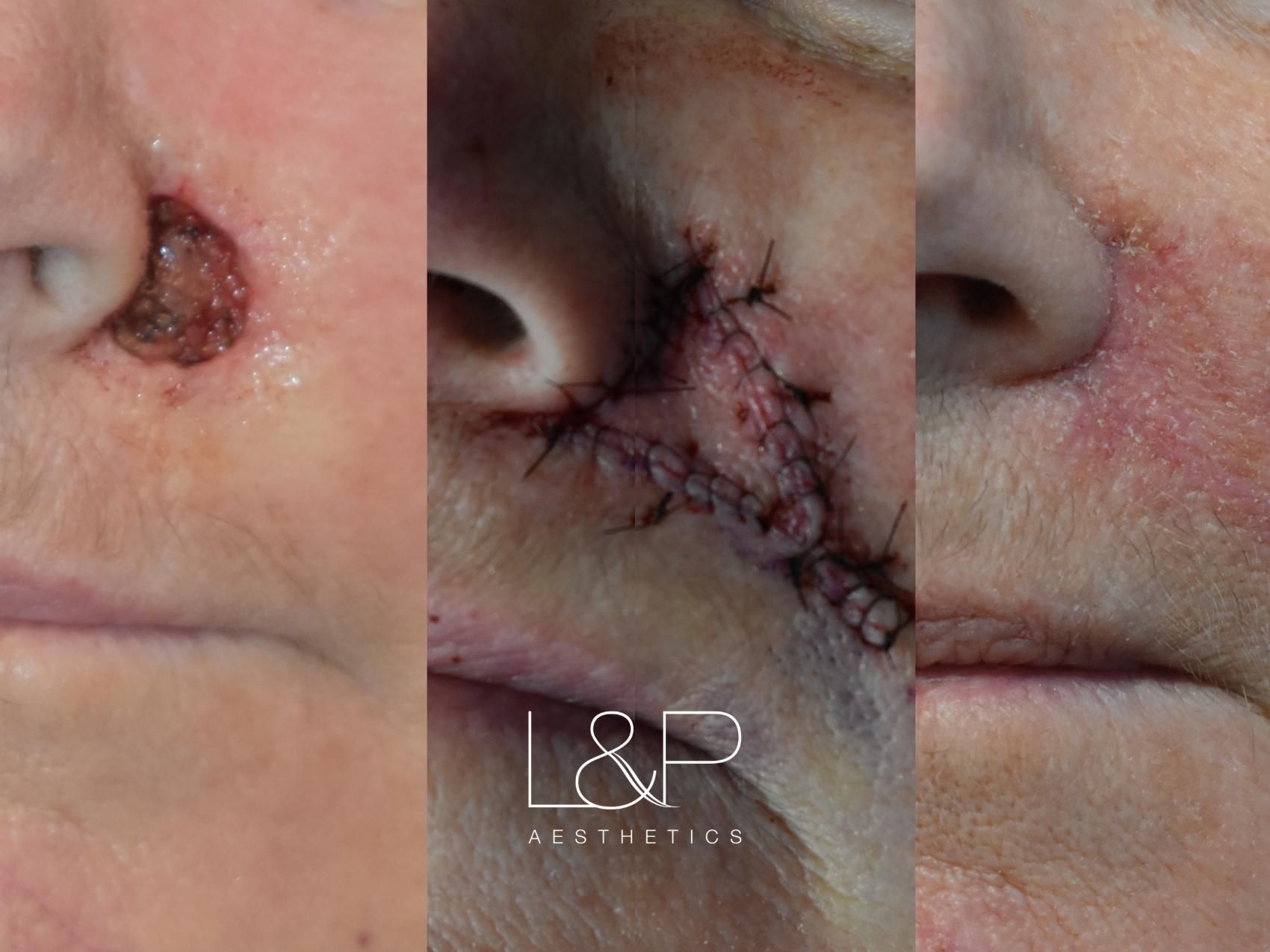 Reconstructive Surgery before and after treatment