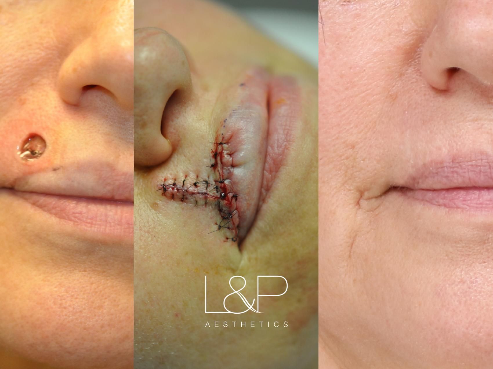 Reconstructive Surgery before and after treatment