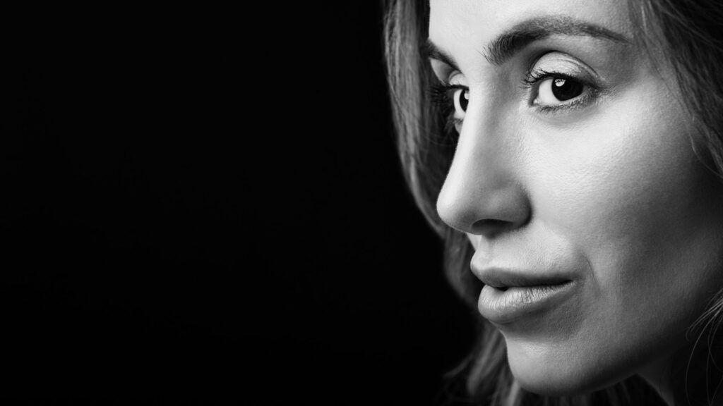 Woman who got a rhinoplasty in Palo Alto, CA at L&P Aesthetics